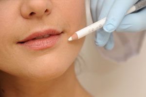 8 Punkte Lift mit Hyaluronsäure für glatte Haut 8 Punkte Lift mit Hyaluronsäure für glatte Haut