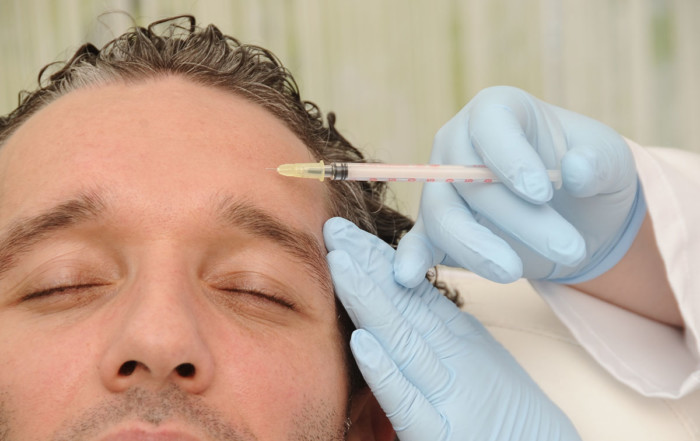 Botox Injektion in die Stirn gegen Migräne