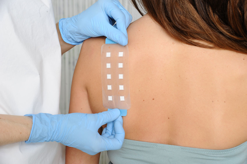 Patch test: Allergy treatment at JUVENIS Epicutaneous test for allergies