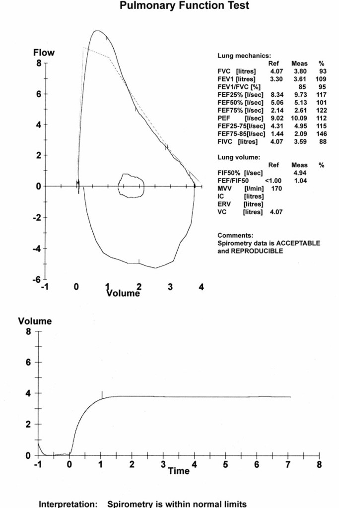 Lungenfunktionsüberprüfung bei JUVENIS Wien Pulmonary function test result sheet