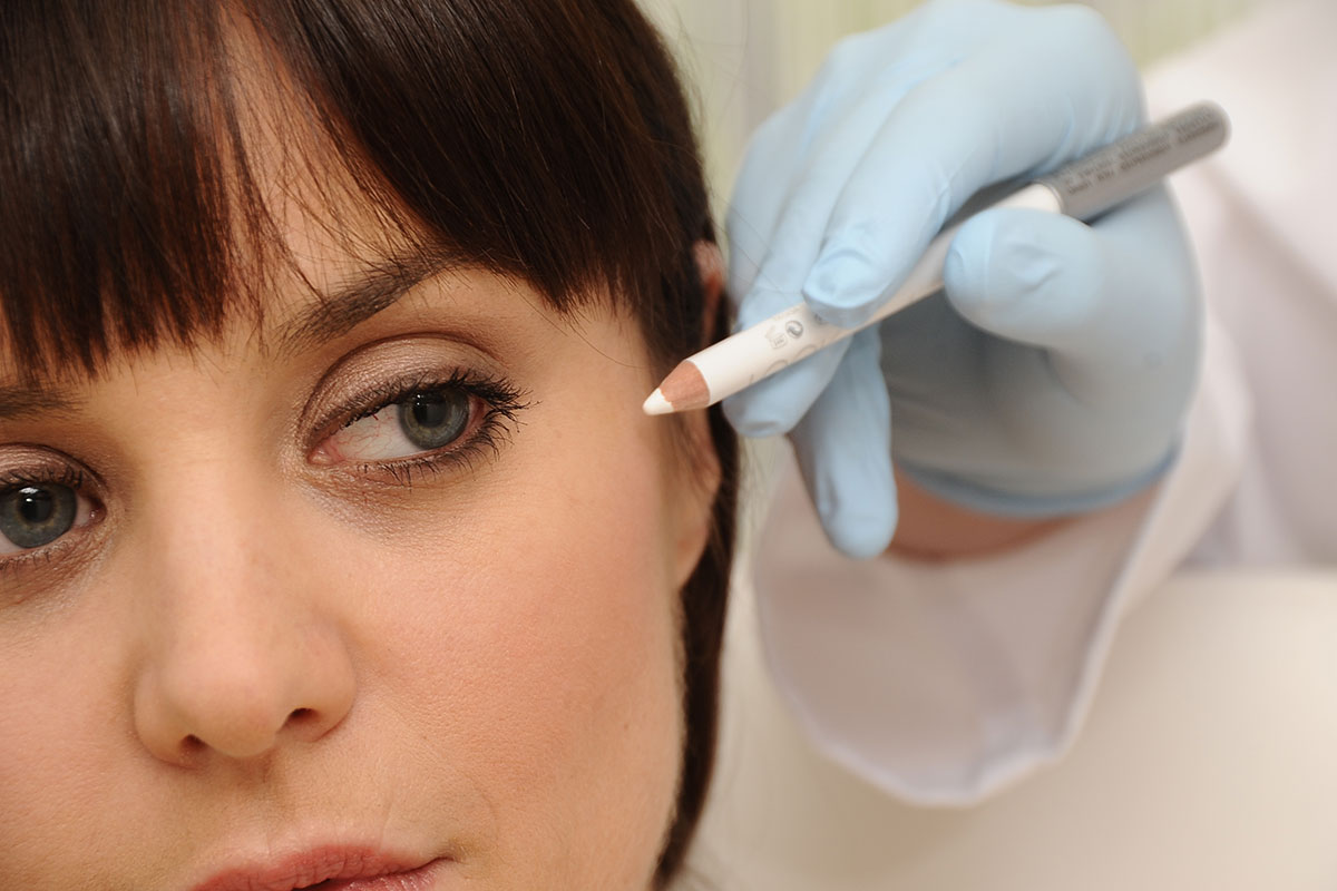 Plastische Chirurgie bei JUVENIS Frau mit weißem Stift