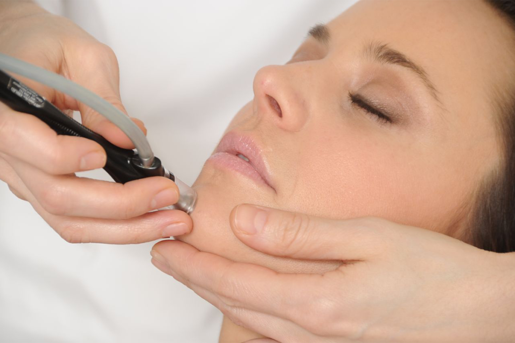 Diamantpeeling (Hydroabrasion) bei JUVENIS Diamantpeeling (Hydroabrasion) bei JUVENIS
