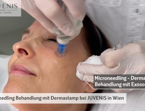 Wie läuft eine Microneedling Behandlung mit dem Dermapen bei JUVENIS ab?
