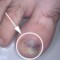 Effektive Behandlung von Nagelpilz bei Dr. Tamara Kopp im JUVENIS Medical Center in Wien